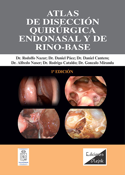 ATLAS DE DISECCION QUIRURGICA ENDONASAL Y DE RINO-BASE